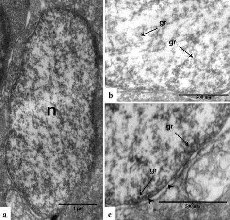 A The Perikaryon Of Degenerating Sensory Receptor Cell Shows A