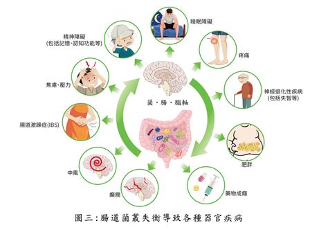 張金堅 ／便秘、憂鬱、中風腸道菌叢失衡百病生！教授曝2個改善重點增加腸道好菌｜張金堅｜名人｜元氣網