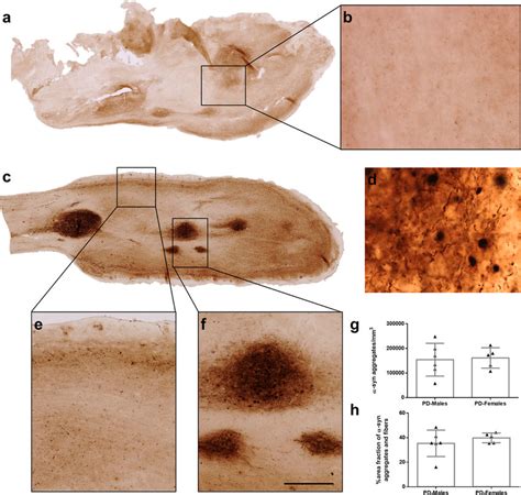 Synucleinopathy Mosaic Reconstruction And High Power Details Of