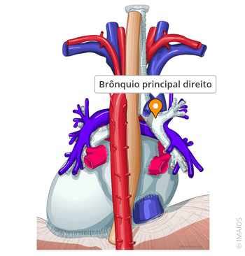 Bronquio Principal Direito