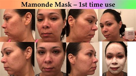 Mamonde Bubble Mask for Oily Acne Prone Skin Review (before & after ...