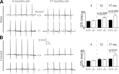 Kcne4 Deletion Sex And Agespecifically Impairs Cardiac Repolarization