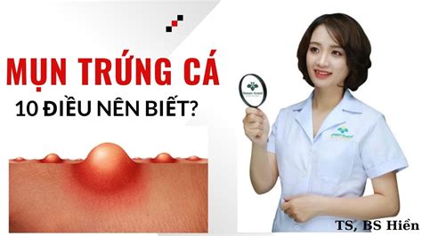 Mụn Trứng Cá Và 10 Điều Cần Biết Để Chăm Sóc Hiệu Quả Tại Nhà - YouTube