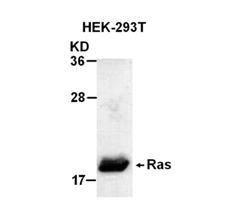 Ras Pab Neweast Biosciences Gtpase And Oncogene