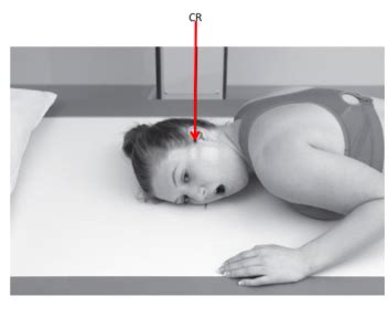 Conventional Imaging Of Tmj Flashcards Quizlet