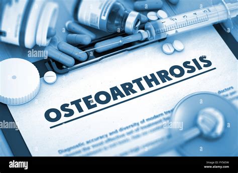 Osteoarthrosis Diagnosis. Medical Concept. 3D Stock Photo - Alamy