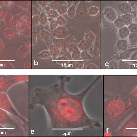 Confocal Micrographs Of Drug Release Of DOX From Ma DOX And F98 The