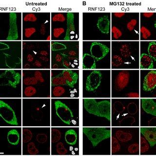 Frap Analysis Of Gfp Hp B And Gfp Hp C A Fluorescence Images Of