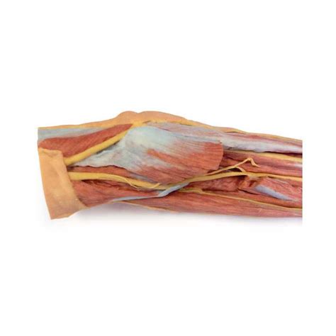 Forearm And Hand Superficial And Deep Dissection D Anatomy Model