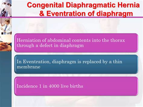 Congenital diaphragmatic hernia / Pediatric surgery | PPT