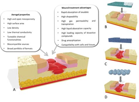 (A) Aerogel properties that are of utmost importance for wound healing ...