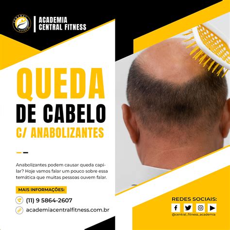 Anabolizantes Podem Causar Queda De Cabelo