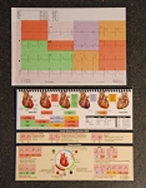 12-lead EKG ECG Overlay To Detect STEMI/NSTEMI —, 03/08/2024