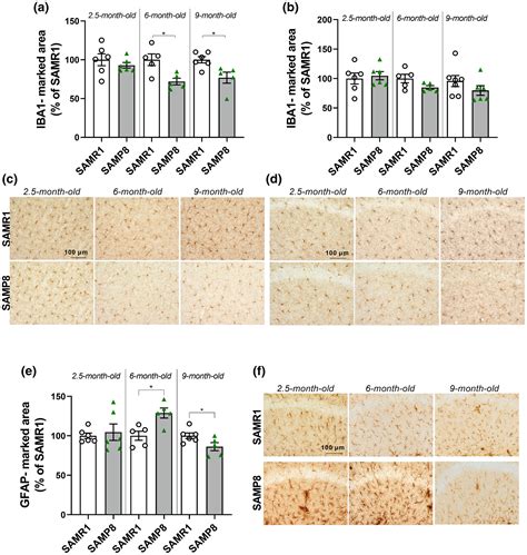 Transcriptomic And Metabolomic Changes Might Predict Frailty In Samp