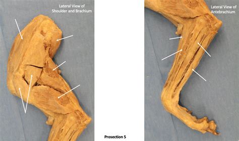 Shoulder Brachium And Antebrachium Of Cadaver Dog Lateral Diagram