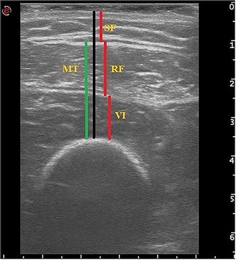 Frontiers Muscle Ultrasound As Imaging Domain Of Frailty