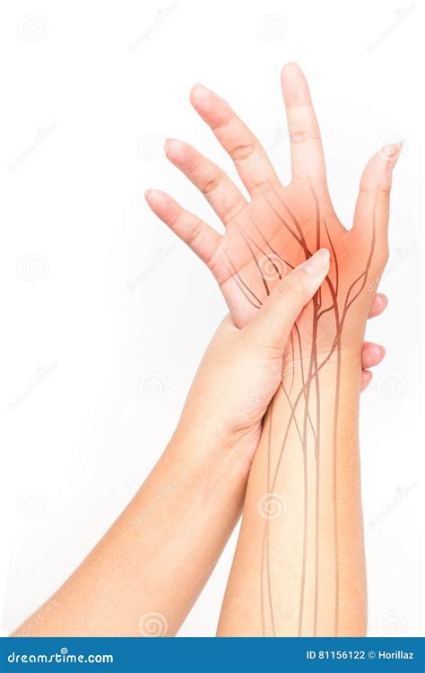 Median Nerve Carpal Tunnel In Hand Pain Woman Injury Wrist Arthritis