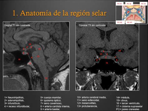 Figure From C Mo Interpretar Un Estudio De Resonancia Magn Tica De