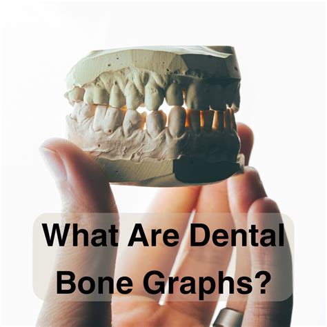 What Are Dental Bone Graphs Mid State Oral Surgery And Implant Center