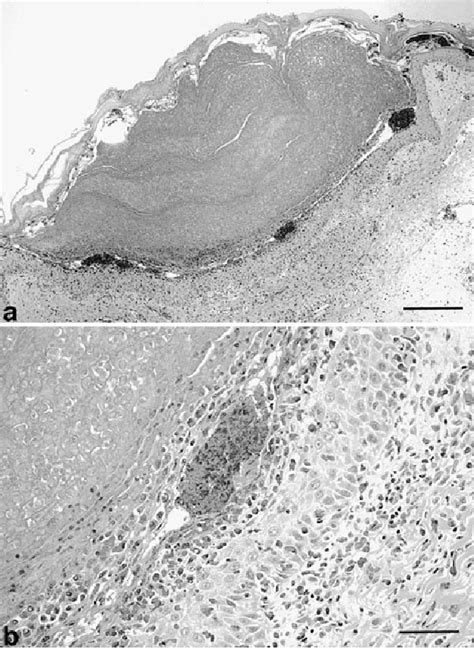 Figure 1 From Dermatophilosis In Captive Tortoises Semantic Scholar