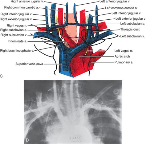 Disorders Of The Sternoclavicular Joint Musculoskeletal Key