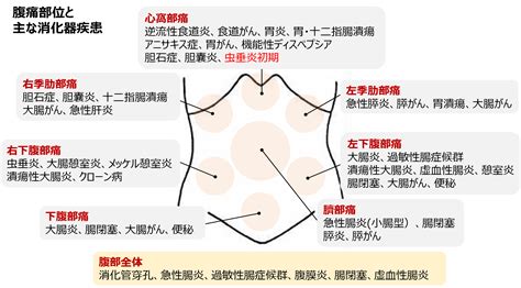 腹痛｜くにちか内科クリニック