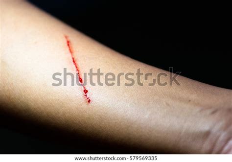 6,667 Knife Wound Stock Photos, Images & Photography | Shutterstock