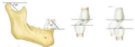 Advanced Occlusion Determinants Of Occlusal Morphology Flashcards