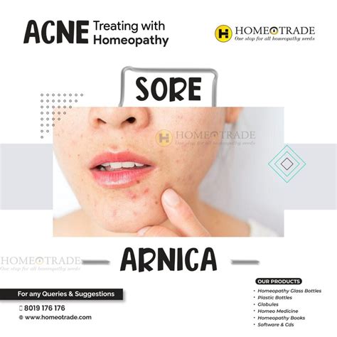 Arnica Homeopathy Homeopathy Near Me Homeotrade