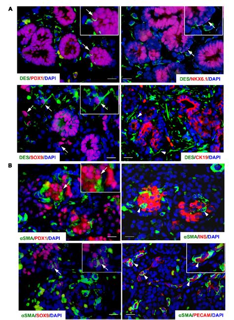 Figure 2 From Activation Of Pancreatic Stellate Cells Is Beneficial For