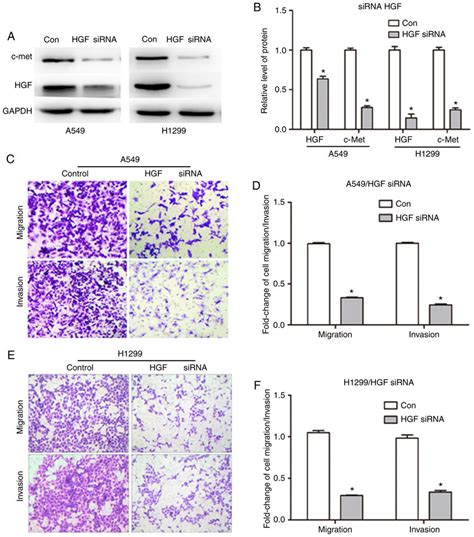 Downregulation Of Hgf Expression Inhibits Nsclc Cell Migration And