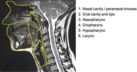 Sagittal Neck Ct Anatomy