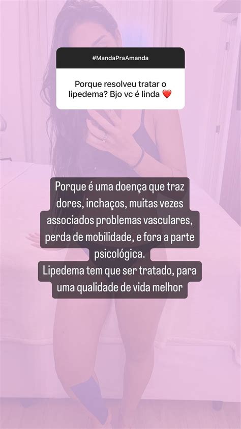 Amanda Djehdian esclarece dúvidas sobre cirurgia de lipedema