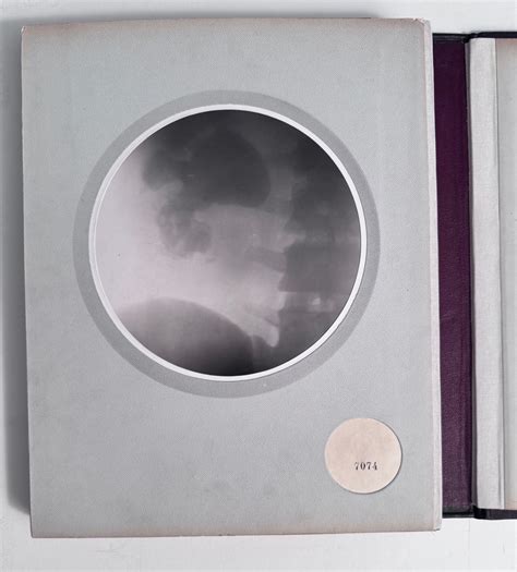 Charles Infroit 1874 1920 Spinal X Rays 1910 Accordion Album With