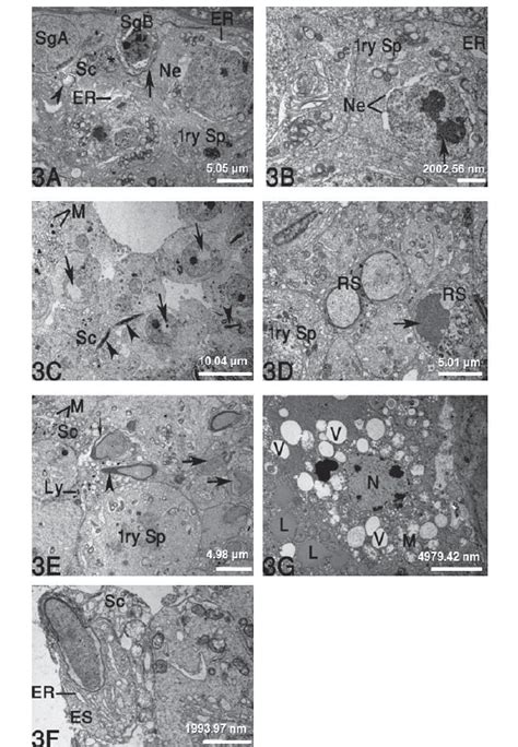 Transmission Electron Micrographs Of The Testicular Cells In Al Treated