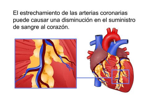 Cómo Prevenir Enfermedades Del Corazón