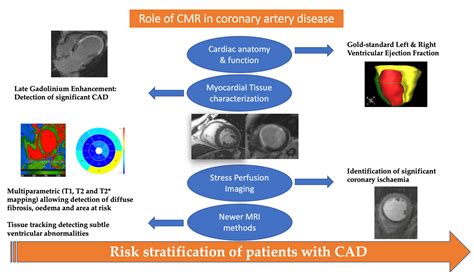 Medicina Free Full Text Contemporary Role Of Cardiac Magnetic