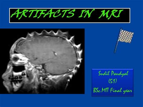 Mri Artifacts