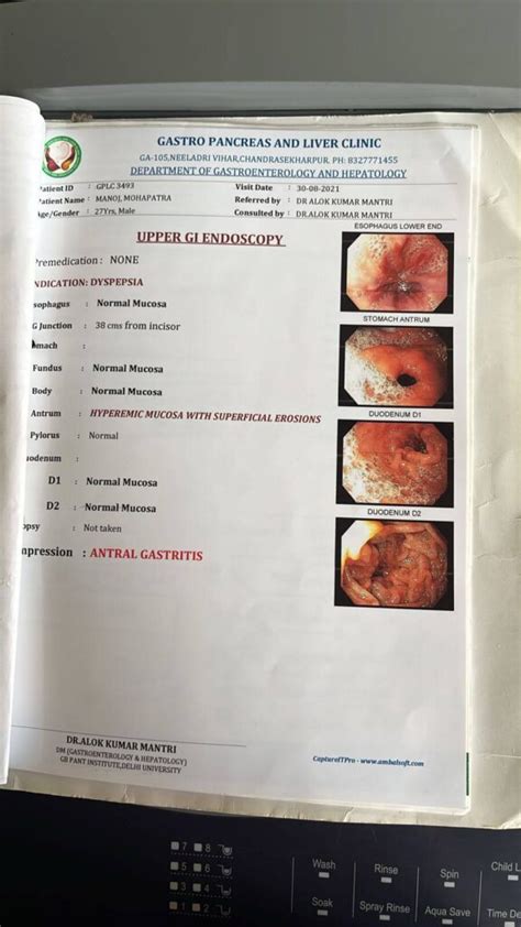 Endoscopy Report Analysis - Hugg Beverages