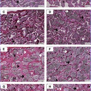 Histological Analysis Of Bone Tissue Formation Kinetics In Female