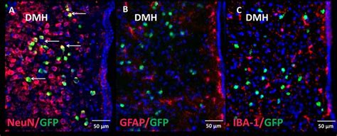 Figure E3 Phenotyping Of ObRb Positive Cells Green In The DMH Of