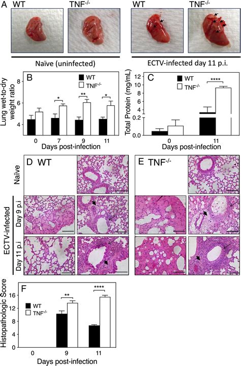 Tnf Deficiency Dysregulates Inflammatory Cytokine Production Leading