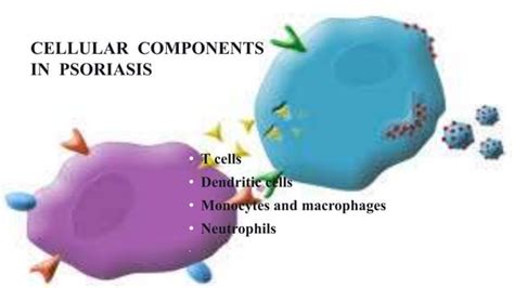 Recent Advances In The Pathophysiology Of Psoriasis Ppt