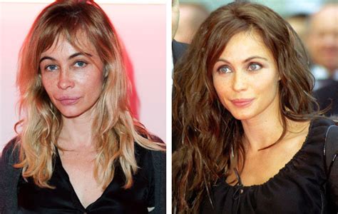 Emmanuelle Beart Plastic Surgery