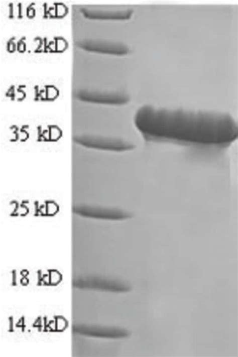 Enquirebio Recombinant Human Gnrh Gnrh Ii Protein G Fisher