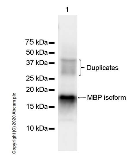 Anti-Myelin Basic Protein antibody [12] (ab7349) | Abcam