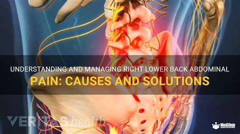 Understanding And Managing Right Lower Back Abdominal Pain: Causes And Solutions | MedShun