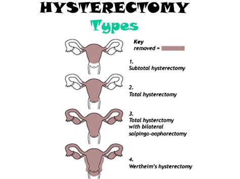 What To Wear After Hysterectomy 11 Tips For A Safe Hysterectomy Recovery