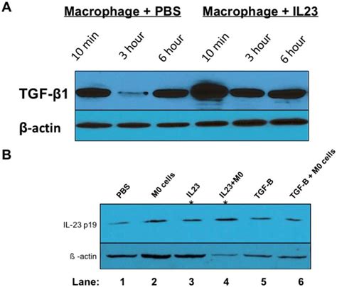 Relationship Between Il23 And Tgf ß Protein Expression In Vitro We