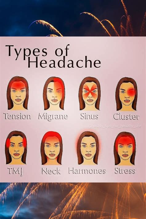 Headache Types Artofit